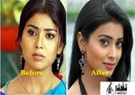 Samantha Prabhu Plastic Surgery Kajal Agarwal Face Plastic S