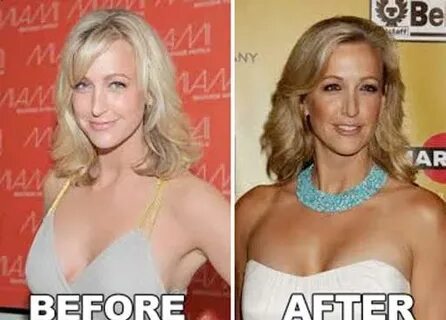 Lara Spencer Plastic Surgery Before and After, Nose, Boob Jo