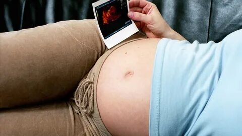 Anatomie des Menschen: Schwangerschaft - Schwangerschaft - N