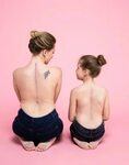 SHARING OUR SCARS - My daughter's bravery during spinal oper