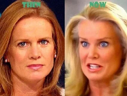 Katty kay plastic surgery - Plastic Surgery