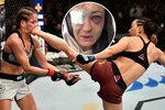 UFC star Karolina Kowalkiewicz left with broken eye socket a
