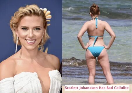 15 Female Celebrities Body-Shamed By The Media