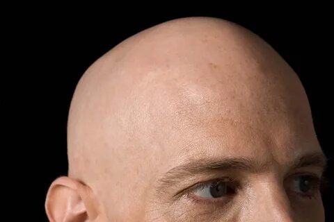 Is there an evolutionary benefit to being bald? New Scientis