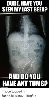 🐣 25+ Best Memes About Funny Xray Meme Funny Xray Memes