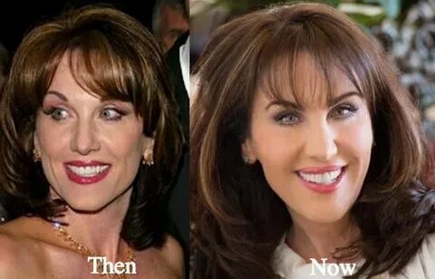 Robin McGraw Plastic Surgery Before And After - Latest Plast