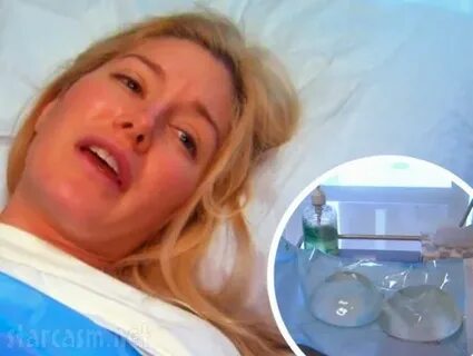 Heidi Montag breast reduction surgery before and after video