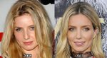Annabelle Wallis Nose Job Plastic Surgery Before and After P