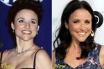 Julia Louis-Dreyfus before and after plastic surgery (21) Ce