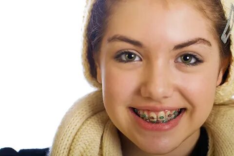 Uses Of Orthodontic Braces In Children " Orthodontic Brace