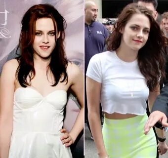 Pin on Kristen Stewart Breast Implant Before and After Photo