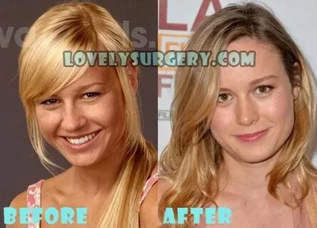 Brie Larson Before and After Plastic surgery, Brie larson, S