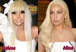 Lady Gaga Plastic Surgery: The Most Famous Chameleon