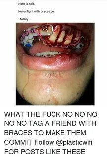 🐣 25+ Best Memes About Fighting With Braces Fighting With Br