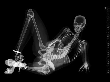 Рентгеновские снимки девушек (60 фото) - секс фото