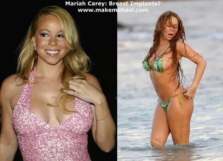 Celebrity Plastic Surgery Mariah Carey Enlargement Breast Im