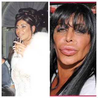 Big Ang Mob Wives ... this lady trips me out. Plastic surger