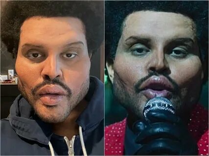 The Weeknd New Look Video / The Weeknd Debuts Plastic Surger