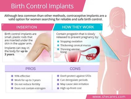 Birth Control Implant SheCares
