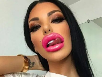 Lips Disaster That Will Shock You (33 Photos) Lips, Beauty, 