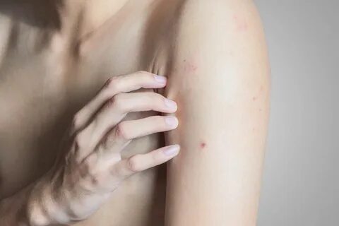 Rote Punkte auf der Haut: 7 mögliche Ursachen BRIGITTE.de