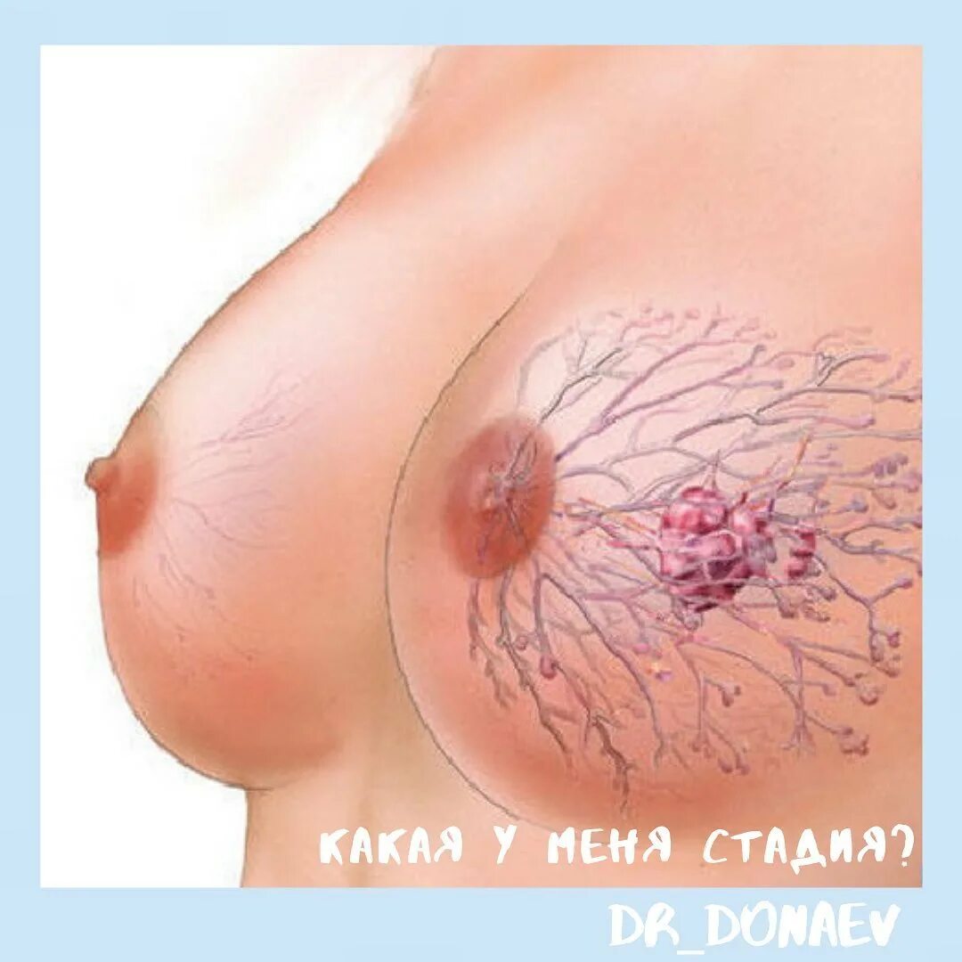 женская грудь и матка фото 22
