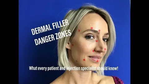 DERMAL FILLER: TOP 10 DANGER ZONES! Dermal fillers, Danger z