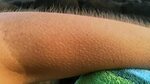 Why Do Certain Experiences Give Us Goosebumps? HowStuffWorks