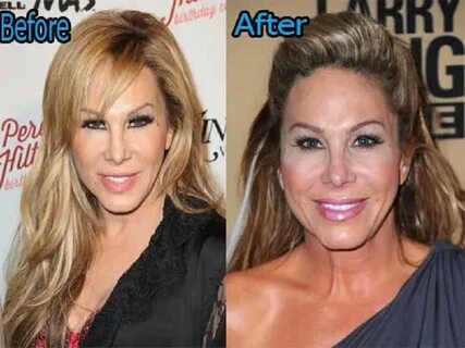 Adrienne Maloof plastic surgery before and after Celebrity s