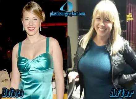 Jodie Sweetin Plastic Surgery Before and After - Plastic Sur