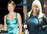Jodie Sweetin Archives - Plastic Surgery Facts
