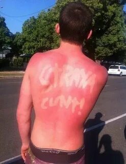 Sunburn in Australia: Australia day, Australia funny, Sick b