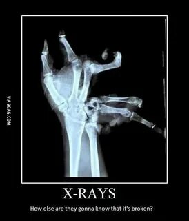Not sure if broken or not - Funny X ray, Bones funny, Humor