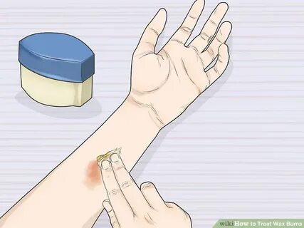 How to Treat Wax Burns: 11 Steps (with Pictures) - wikiHow