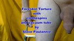 Vacuum foreskin torture by slave Paulannie - ThisVid.com