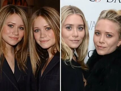 Ashley and Mary-Kate Olsen before and after plastic surgery 