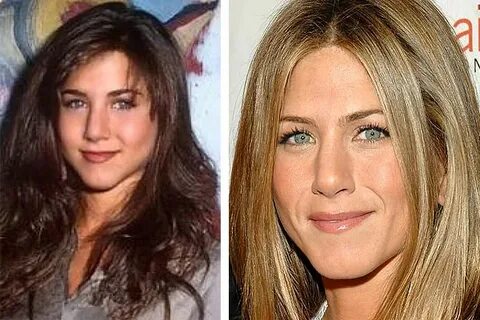 Jennifer Aniston Plastic Surgery - What has she had Done?