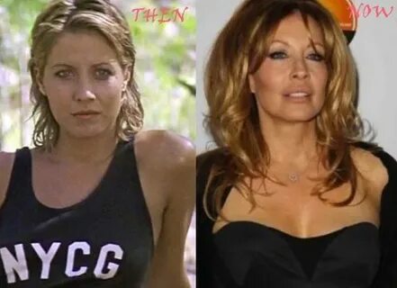 Linda Kozlowski Plastic Surgery - With Before And After Phot