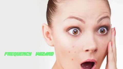 Get Rid of Acne, Pimples, Zits, Blemishes Fast! Frequency Wi