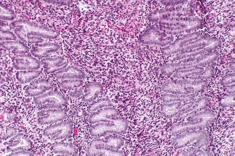 File:Coiled endometrium -- intermed mag.jpg - Wikimedia Comm