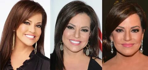 Robin Meade Plastic Surgery Before and After Pictures 2022