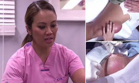 Dr Pimple Popper Videos 2019