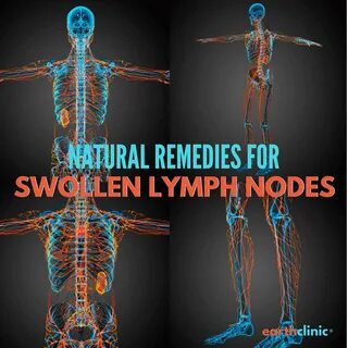 How to Treat Swollen Lymph Nodes Using Natural Remedies