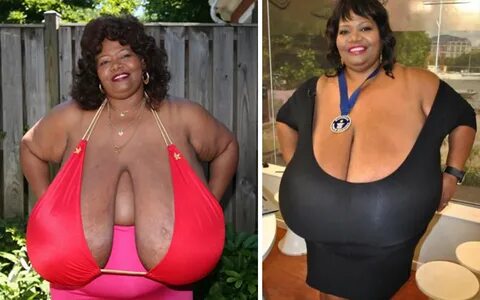 Dünyanın En Büyük Göğüslerine Sahip Kadın Norma Stitz - Hadibeh.com