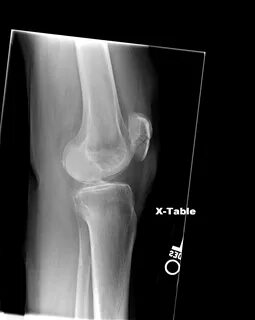 EM REMS Category Archive Orthopedics