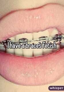 Braces Fetish Stories - Porn photos HD and porn pictures of 