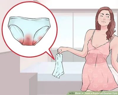 4 Ways to Treat a Ruptured Ovarian Cyst - wikiHow