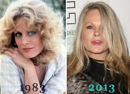Beverly D Angelo Plastic Surgery Beverly d'angelo, Plastic s