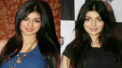 Bollywood actress before and after plastic surgery (of lips)