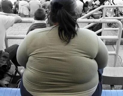 Sobrepeso y obesidad son la principal epidemia del país - Cu